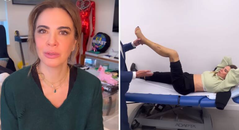 Luciana Gimenez Mostra Imagens Fortes De Hematomas E Pontos Na Perna