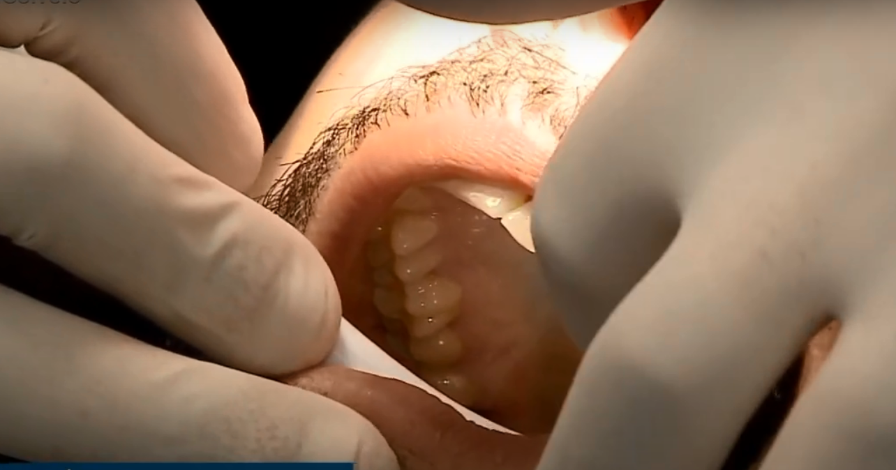 Mau hálito dentista