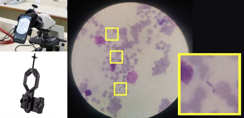 Estudo Doença de Chagas, inteligência artificial