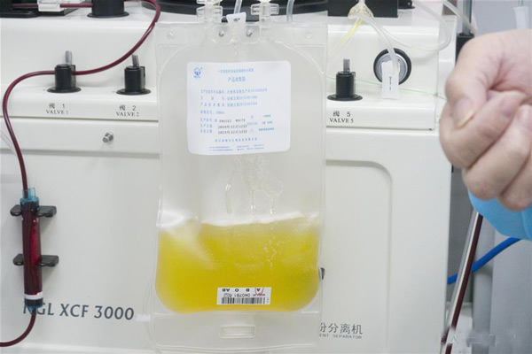 Plasma